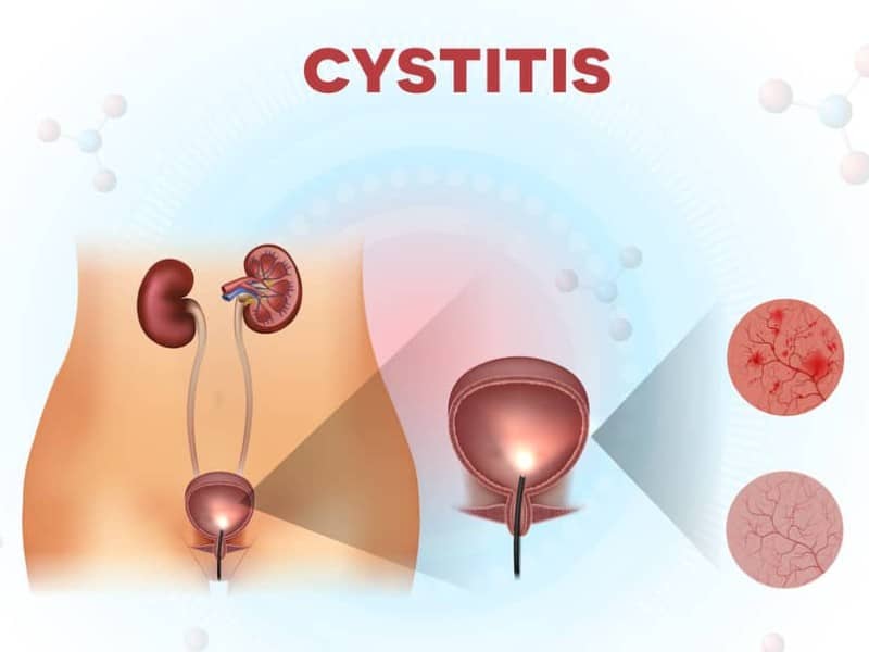 Cystitis-Bloom-Medicinals